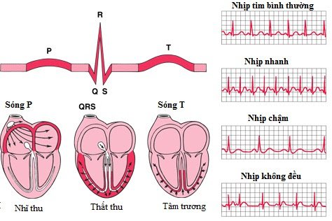 Suy tim ở trẻ em - ảnh 2