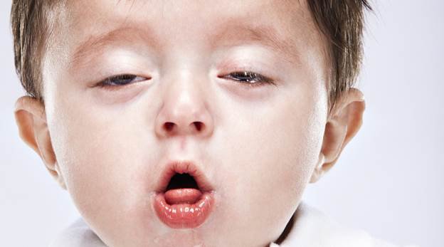 Bệnh ho gà: Nguyên nhân, triệu chứng, biến chứng và cách điều trị - ảnh 1