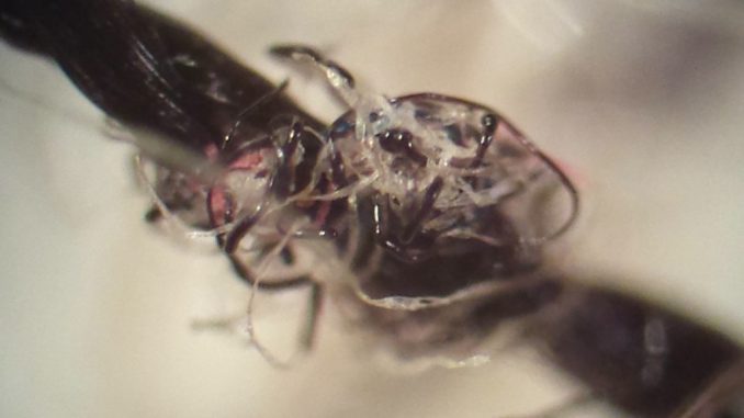 Morgellons - Hình ảnh minh họa