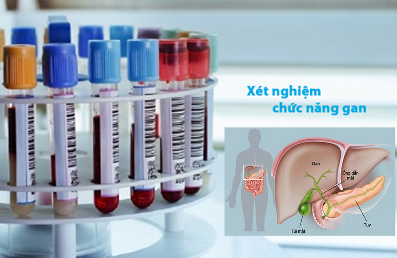 Vai trò và chức năng của men gan - Nguyên nhân khiến men gan tăng cao (Kỳ I) - ảnh 1