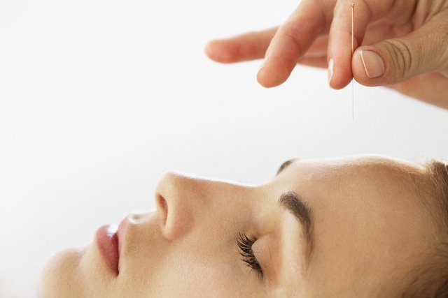 Liệt dây thần kinh số VII (liệt mặt) có nguy hiểm không? - ảnh 2