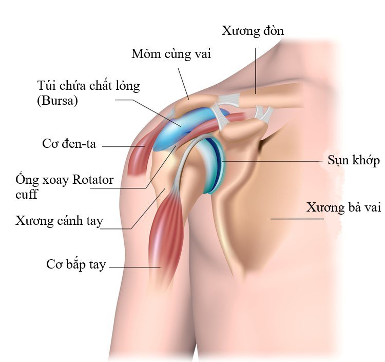 Điều trị viêm chóp xoay khớp vai bằng huyết tương giàu tiểu cầu - ảnh 1