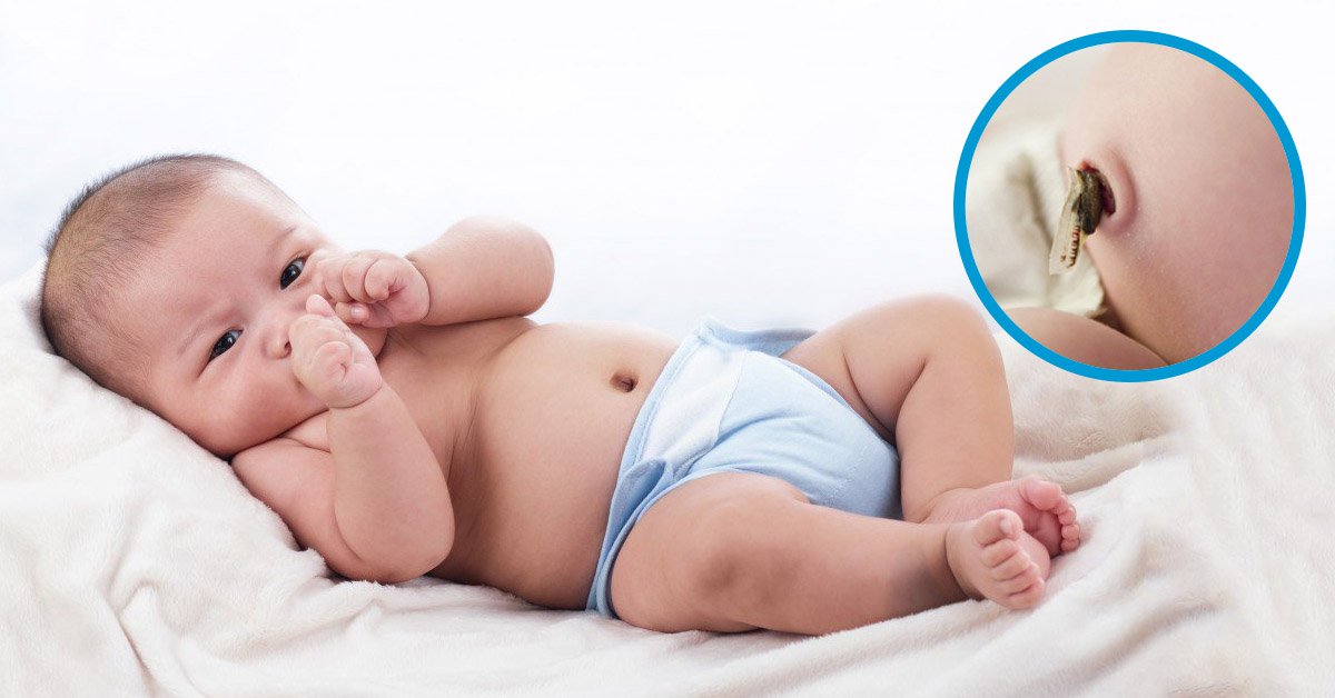 Bà bầu không tiêm phòng uốn ván có sao không? - ảnh 1
