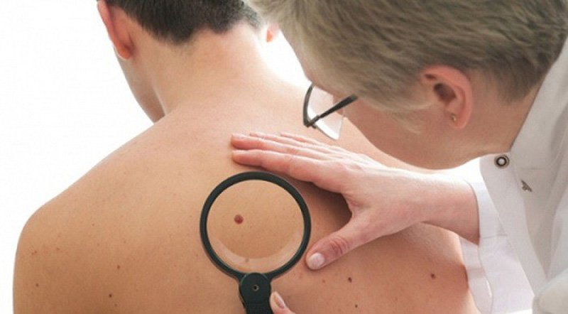 Những loại ung thư có khả năng chữa được cao nhất ? - ảnh 2