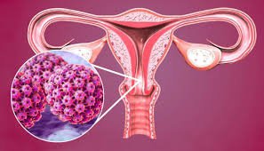 Vắc-xin HPV: Ai nên tiêm và tiêm khi nào? - ảnh 2