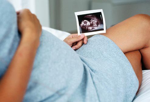 Mang thai có được tiêm phòng vắc-xin viêm não Nhật Bản? - ảnh 2