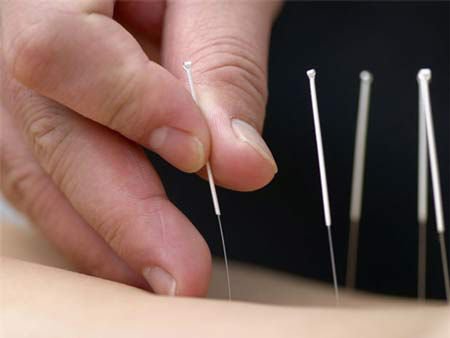 Chữa đau đầu, đau nửa đầu hiệu quả bằng tác động cột sống - ảnh 2