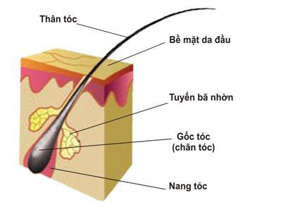 Cấy tóc: Những điều cần biết - ảnh 1