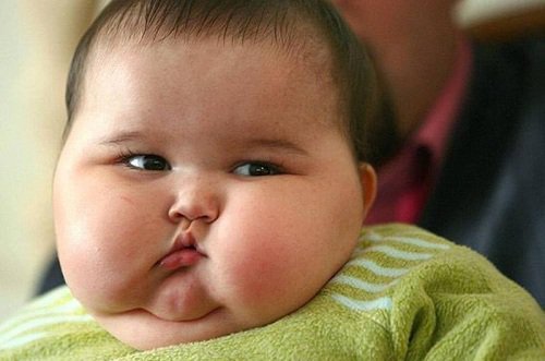 Bệnh lý Béo phì ở trẻ em: Nguyên nhân và có nguy hiểm không - ảnh 2