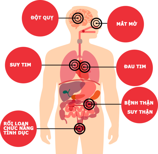 Tăng huyết áp: Chỉ số huyết áp, nguyên nhân và triệu chứng - ảnh 2