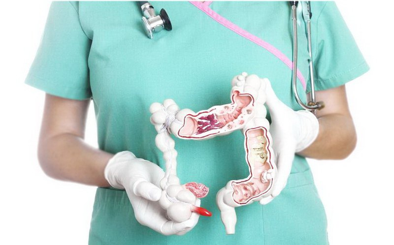 Chẩn đoán và điều trị viêm ruột thừa cấp - ảnh 1
