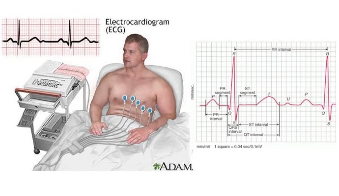 Xét nghiệm và chẩn đoán huyết áp thấp - ảnh 1