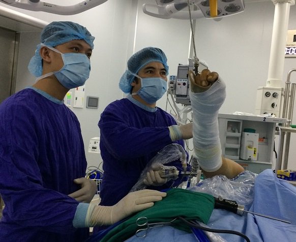 Phương pháp Nội soi Chẩn đoán các bệnh về khớp vai - ảnh 3