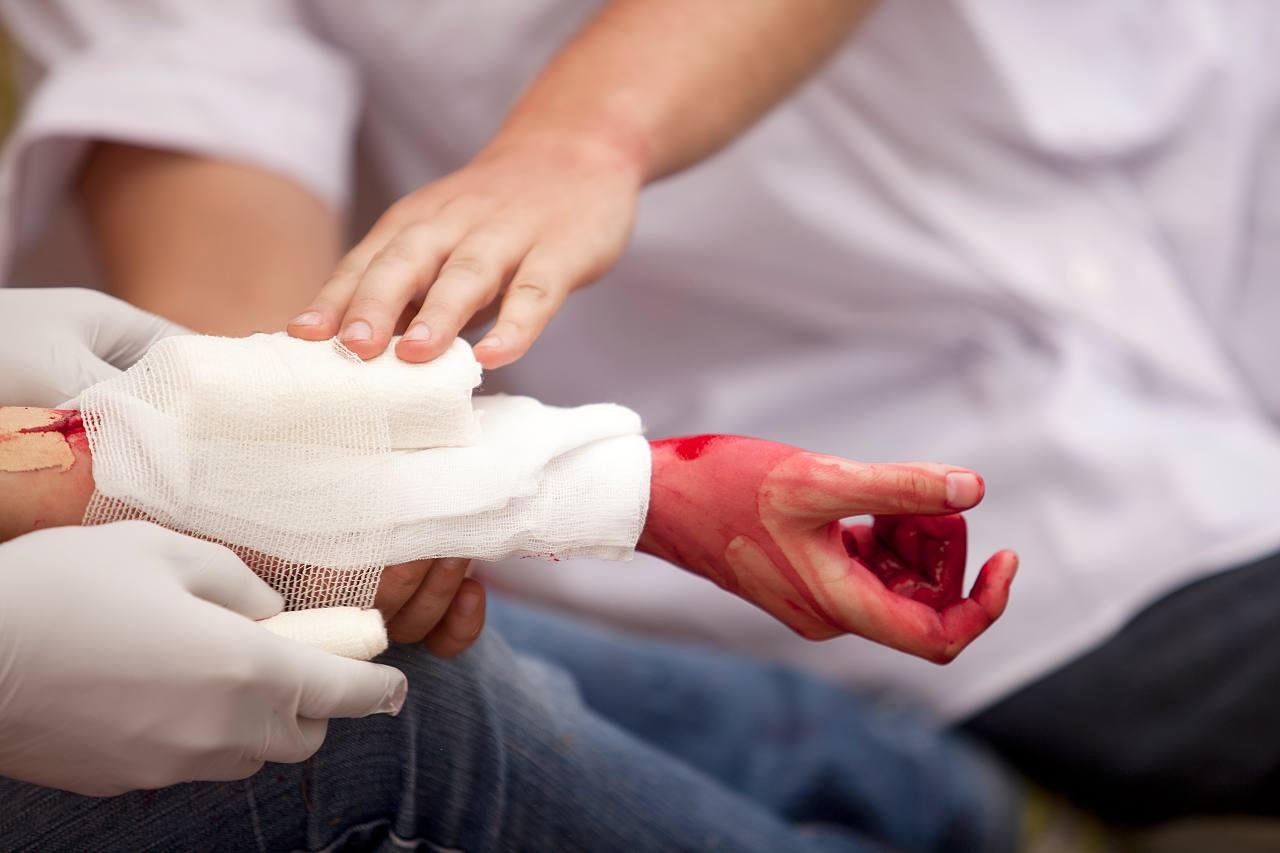 Gãy xương có biến chứng nguy hiểm nếu không điều trị sớm - ảnh 1