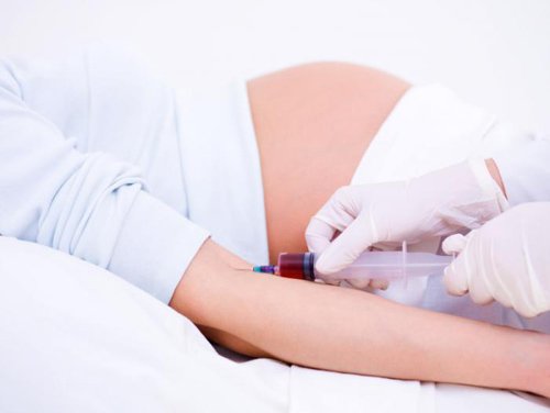 Ý nghĩa xét nghiệm PAPP-A và free beta HCG (Double test)trong sàng lọc dị tật - ảnh 3