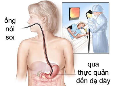 Nội soi can thiệp đường tiêu hóa và Những điều cần biết - ảnh 1
