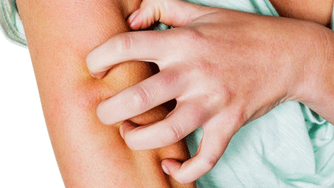 Biến chứng suy thận mạn giai đoạn cuối - ảnh 1