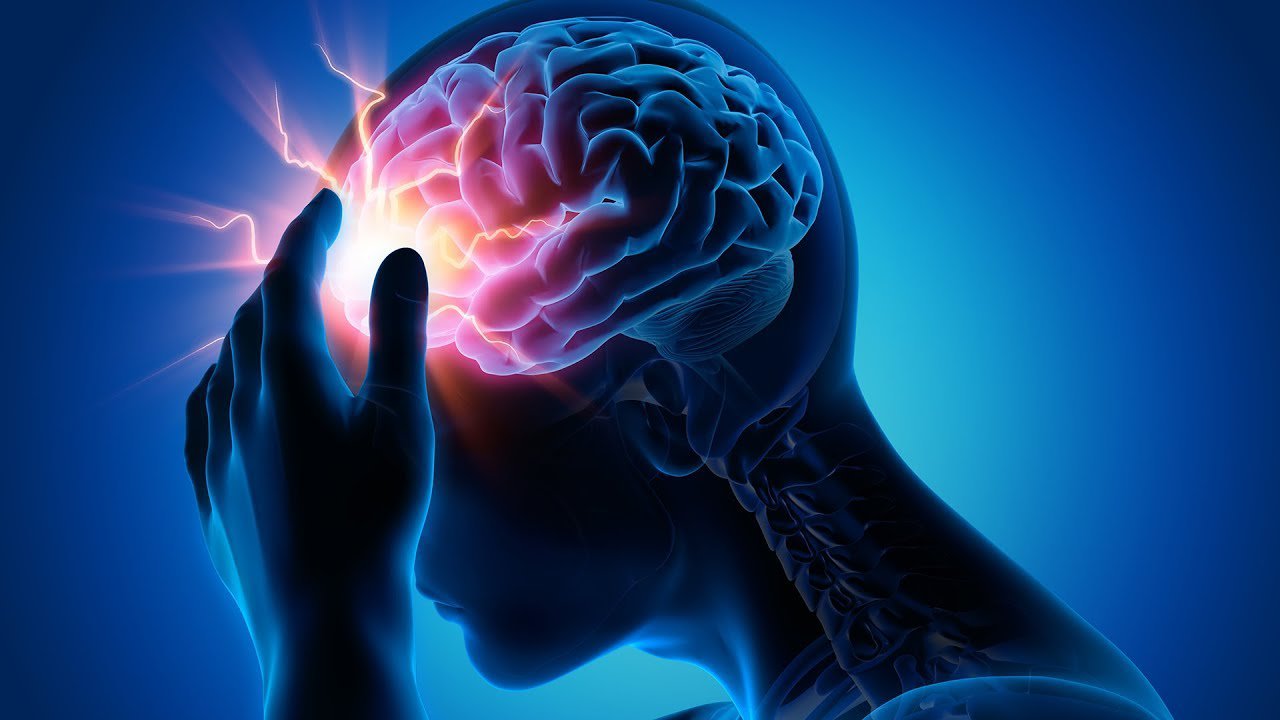 Thuốc tiêu sợi huyết Điều trị nhồi máu não - ảnh 1