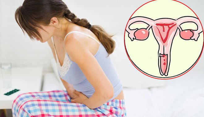 U nang buồng trứng là bệnh gì? Liệu có thể trở thành ung thư buồng trứng? - ảnh 2