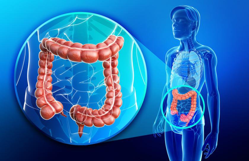 Tầm soát ung thư đại trực tràng bằng nội soi dải tần ánh sáng hẹp NBI - ảnh 1