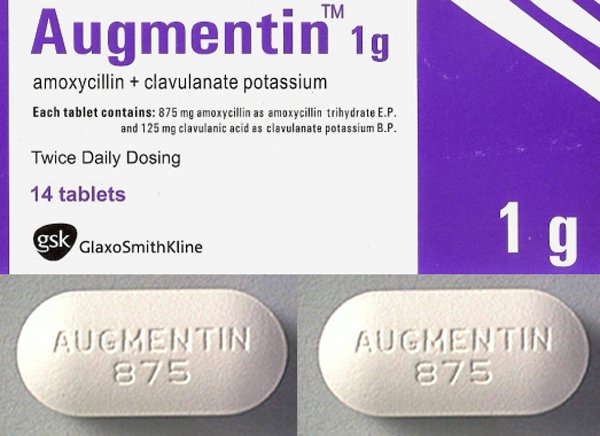 Những tác dụng phụ của thuốc Augmentin mọi người cần biết - ảnh 2