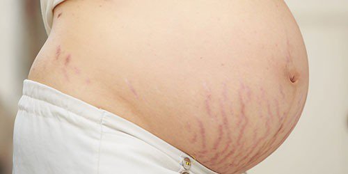 Sự thay đổi của bà bầu tuần 37 mẹ bầu cần biết - ảnh 2