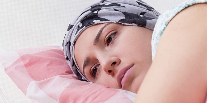 Các tác dụng phụ khi Xạ trị bệnh nhân ưng thư cần biết - ảnh 2