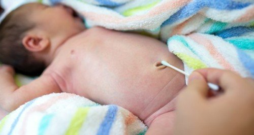 Những dấu hiệu bất thường ở rốn trẻ sơ sinh các mẹ cần biết - ảnh 1