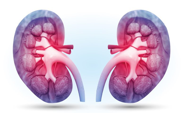 Tán sỏi ngoài cơ thể: Không đau, không cần gây mê, ít sót sỏi - ảnh 2