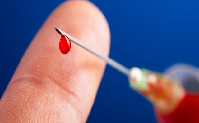 Viêm gan virus B: Nguyên nhân, con đường lây nhiễm, triệu chứng và Cách điều trị - ảnh 1