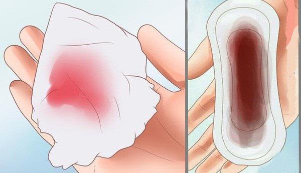 Nguyên nhân chảy máu kinh nguyệt nhiều - ảnh 1