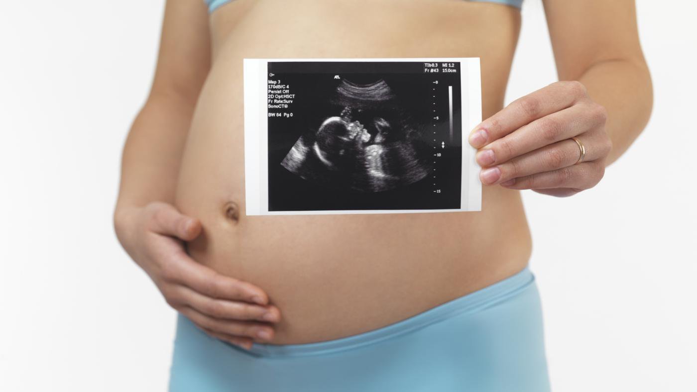 Siêu âm thai nhi 2D nhiều có an toàn không? - ảnh 2
