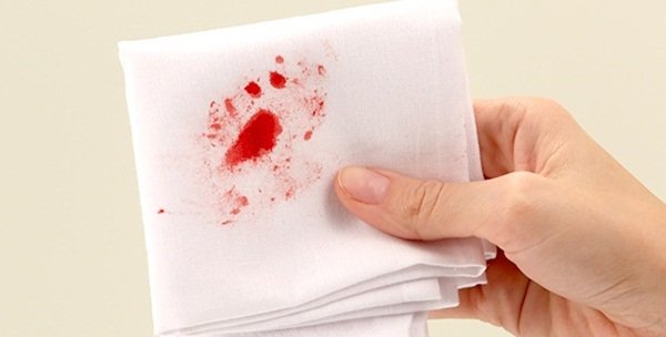 Ung thư hậu môn triệu chứng và cách điều trị - ảnh 1