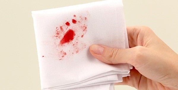 Dấu hiệu nhận biết Ung thư hậu môn - ảnh 1