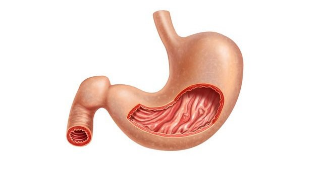 Chẩn đoán sớm chứng teo niêm mạc dạ dày - ảnh 1