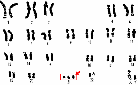 Nhiễm sắc thể đồ