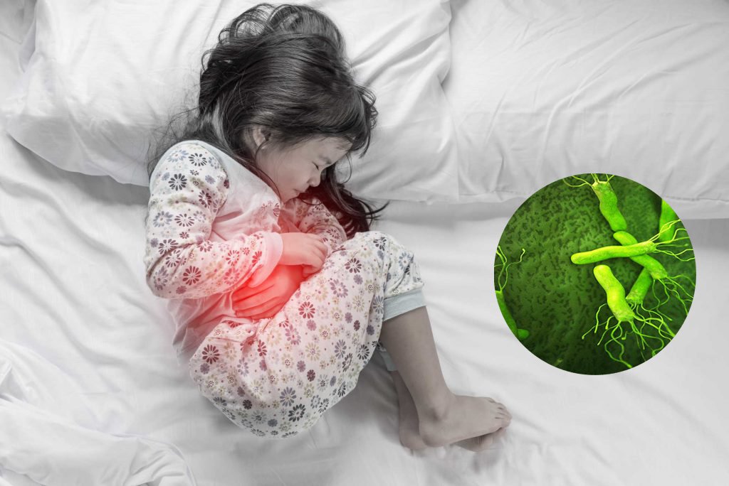 Các yếu tố nguy cơ gây ra ung thư dạ dày - ảnh 1