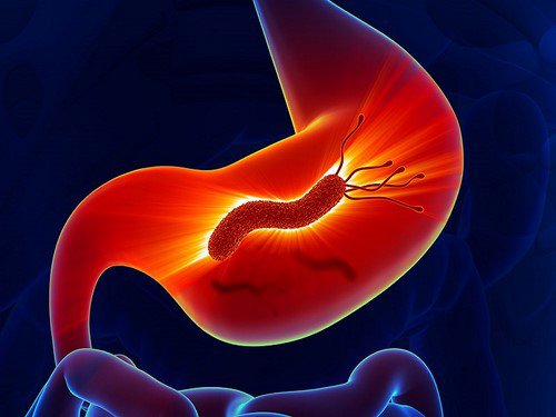 Nhiễm vi khuẩn HP (Helicobacter pylori) dạ dày có nguy hiểm không? - ảnh 2