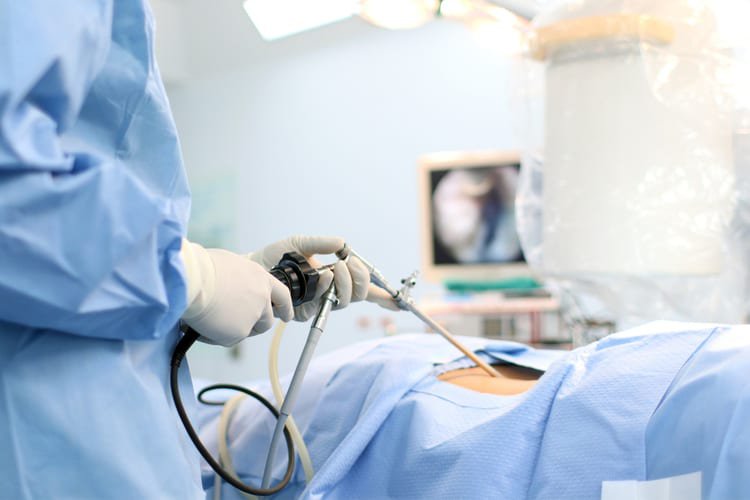 Cắt dạ dày điều trị viêm loét dạ dày tá tràng - ảnh 2