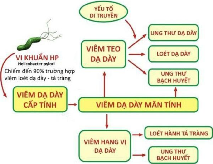 Những điều cần biết về vi khuẩn HP - ảnh 1