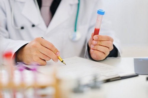 Hormone TSH và ý nghĩa trong chẩn đoán sàng lọc các bệnh lý tuyến giáp cũng như theo dõi hiệu quả điều trị