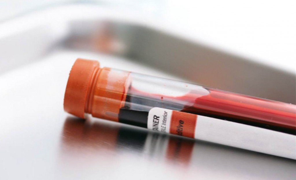 Xét nghiệm anti HBs