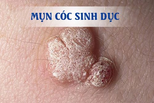 Những nguyên nhân gây ngứa hậu môn - ảnh 3