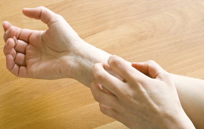 Bệnh mụn nước thông thường sẽ gây ngứa rát