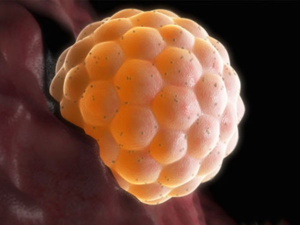 Thai trứng xâm lấn: Những điều cần biết