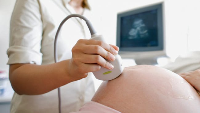 6 phương pháp siêu âm tim thường dùng - ảnh 1