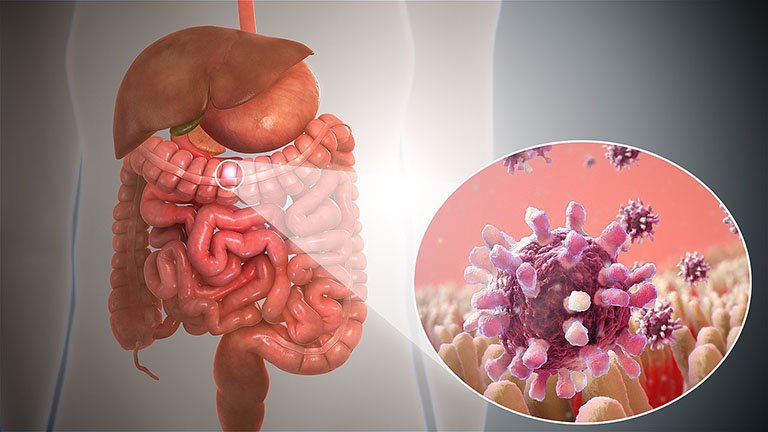 Vi khuẩn Shigella gây bệnh gì? - ảnh 1