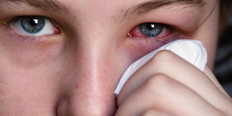 Vi khuẩn Shigella gây bệnh gì? - ảnh 2