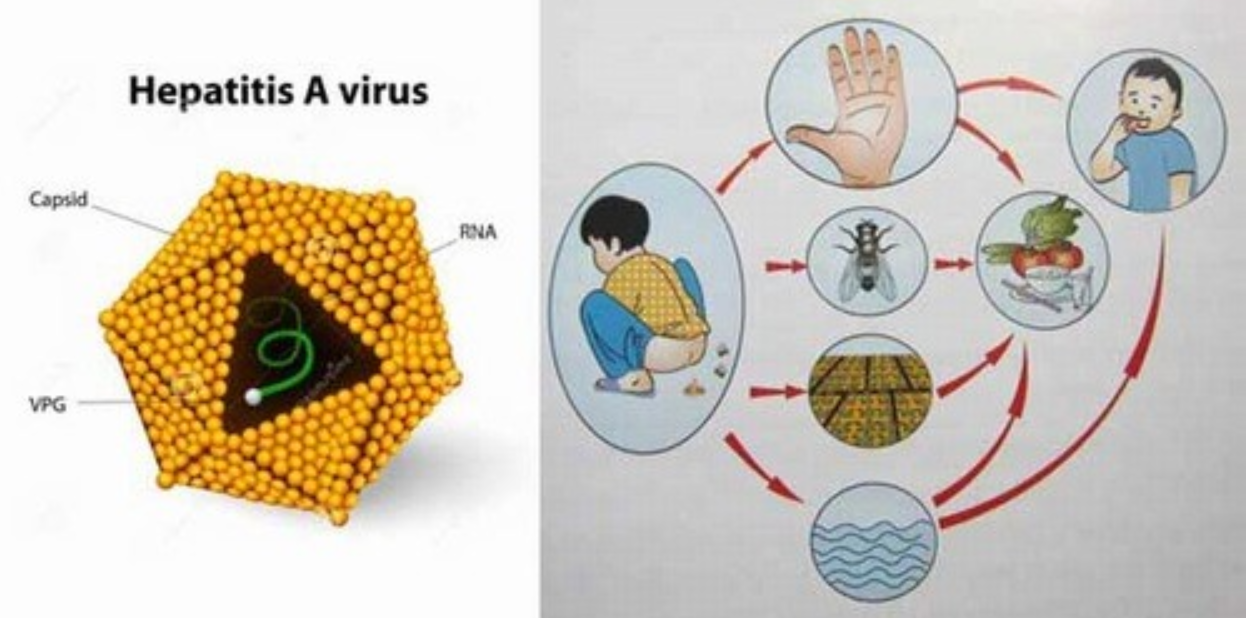 Viêm gan lây