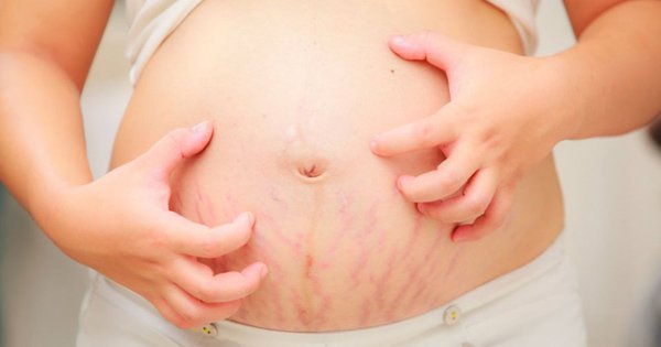 Các giai đoạn của bệnh giang mai - ảnh 2